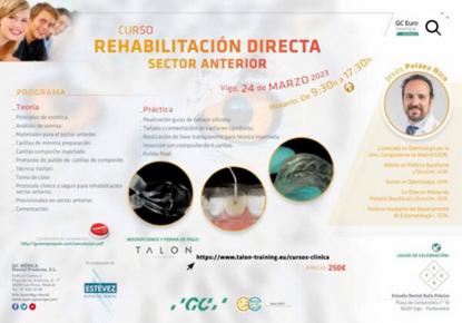 Curso de Rehabilitaci�n Directa del sector anterior - Foto 1