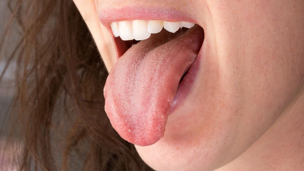 �Por qu� debo limpiar mi lengua? - Foto