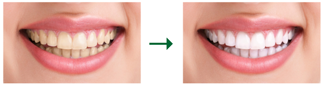 Est&eacute;tica